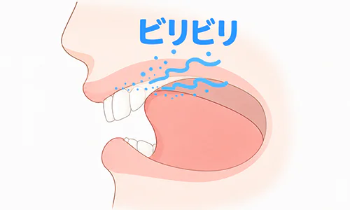 舌先に伝わる「ビリビリ」という微細な振動を示した口内図